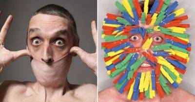 Может натянуть кожу с шеи на рот: рекордсмен Книги рекордов Гиннеса имеет редкое заболевание (фото) - focus.ua - Украина - Англия