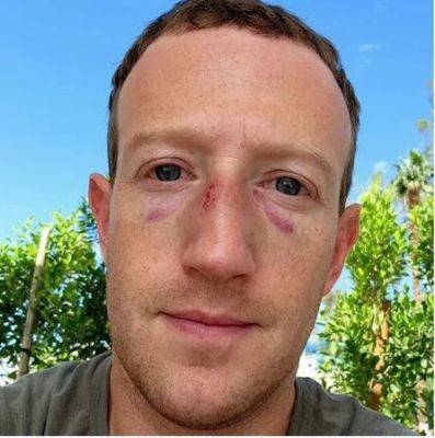 Марк Цукерберг - Владимир Хрюнов - Илоной Маской - Цукерберг опубликовал фото с избитым лицом на фоне слухов о бое с Илоном Маском - obzor.lt