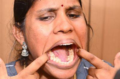 "Главное достижение в жизни": Индианка побила мировой рекорд по количеству зубов - obzor.lt - Индия - Канада