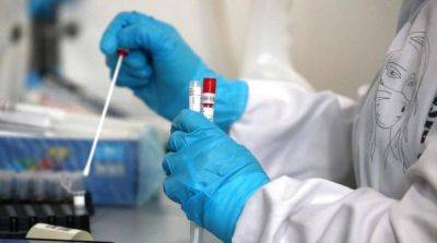 В МОЗ назвали количество случаев гепатита в Винницкой и еще четырех областях - ru.slovoidilo.ua - Украина - Винницкая обл.