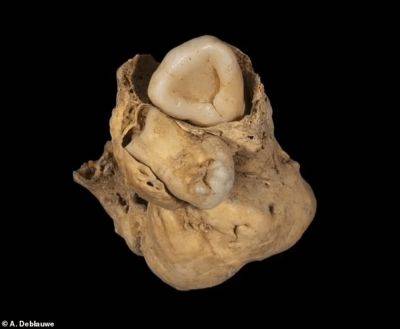 В Египте в гробнице нашли опухоль яичника с зубами - фото - apostrophe.ua - Россия - Украина - Египет