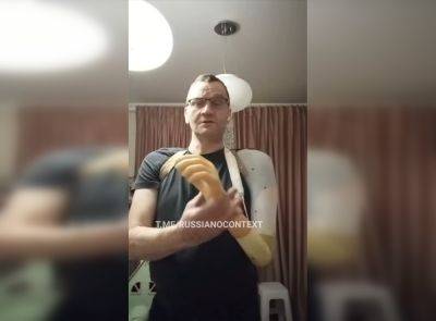 Россиянин показал протез руки, полученный бесплатно – видео - apostrophe.ua - Россия - Украина - Сколково - Донецк