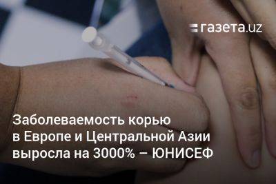 Заболеваемость корью в Европе и Центральной Азии выросла на 3000% — ЮНИСЕФ - gazeta.uz - Казахстан - Узбекистан - Румыния - Киргизия
