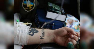 «Осколок от снаряда попал прямо в гранату, висевшую у меня на поясе. Она взорвалась, разорвав живот, повредив руки и ноги» - fakty.ua - Украина