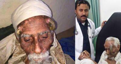 Прозвали "двурогим": в Йемене мужчина умер после неудачной операции по удалению наростов - focus.ua - Украина - Венесуэла - Йемен