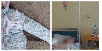 Собаки напали на мать и ребенка из-за невнимательности хозяина, кадры: "забыл закрыть дверь питомника" - popcorn.politeka.net - Украина - Киев