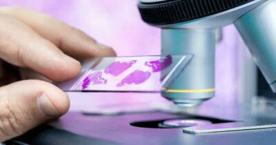 Прорывное устройство для диагностики рака анализирует образцы тканей за 30 минут - focus.ua - Украина