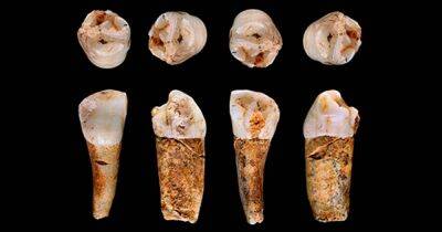 Как древние люди выживали и питались: их зубы раскрывают подробности - focus.ua - Украина - Англия - Португалия
