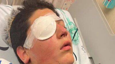 13-летний Илай может потерять глаз из-за детской шалости в Лаг ба-омер - vesty.co.il - Израиль