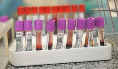 Минздрав Беларуси заявил о внедрении теста PanTum Detect, который выявляет более 60 видов рака - obzor.lt - Белоруссия - Германия