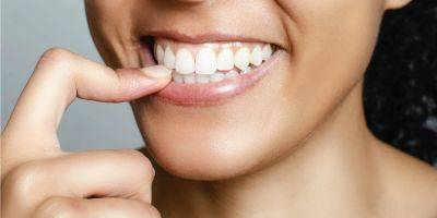 Совершенная улыбка. Четыре способа отбелить зубы без вреда для эмали - nv.ua - Украина