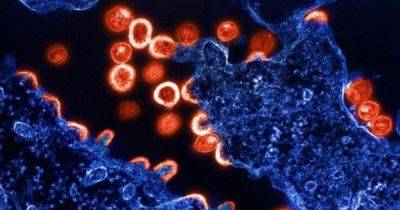 Выманить и убить. Ученые нацелили новую молекулу на уничтожение самого живучего типа ВИЧ - focus.ua - Украина - Токио - Япония