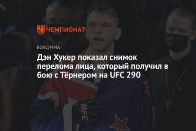 Дана Уайт - Дэн Хукер - Дэн Хукер показал снимок перелома лица, который получил в бою с Тёрнером на UFC 290 - championat.com - Новая Зеландия