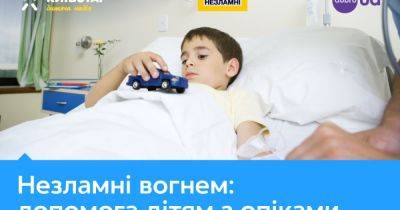 "Киевстар" профинансировал медицинское оборудование для лечения детей с ожогами - dsnews.ua - Украина