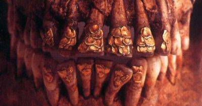 Древняя стоматология была дорогой: о чем рассказал старинный череп с золотыми зубами - focus.ua - Китай - Украина - Филиппины - Находка