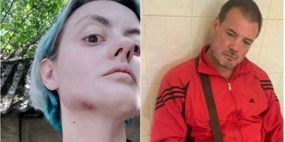 Офицеру ТЦК, который пьяным избил в Ужгороде женщину, сообщили о подозрении - nv.ua - Украина - Ужгород