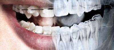 Нейросеть способна с точностью до 94% определять пол людей по рентгеновским снимкам зубов - obzor.lt