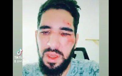 Второй случай за месяц гомофобии в Реховоте: возле бара избит 31-летний мужчина - nashe.orbita.co.il - Израиль