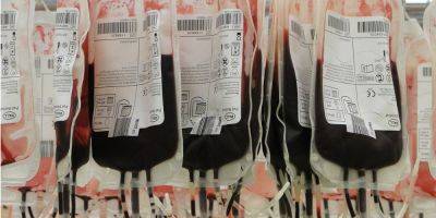 Виктор Ляшко - В случае чрезвычайных ситуаций донорскую кровь в Украину смогут завозить из-за границы — Минздрав - nv.ua - Россия - Украина