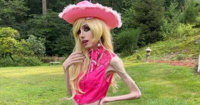 Блогер - Блогер YouTube с анорексией примерила наряды Барби и вызвала сочувствие подписчиков (видео) - focus.ua - Украина