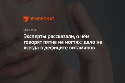 Эксперты рассказали, о чём говорят пятна на ногтях: дело не всегда в дефиците витаминов - championat.com