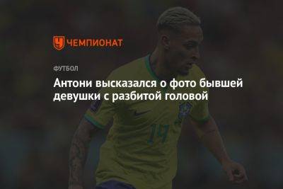 Антони высказался о фото бывшей девушки с разбитой головой - championat.com - Бразилия