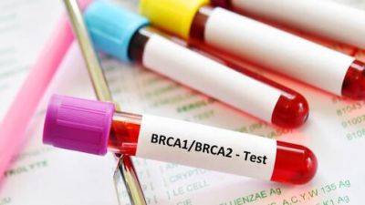 Почему в Израиле врачи направляют женщин на анализ BRCA - vesty.co.il - Израиль - Иерусалим - Почему