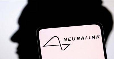 Первый пациент Neuralink может управлять компьютерной мышью с помощью мышления - gagadget.com