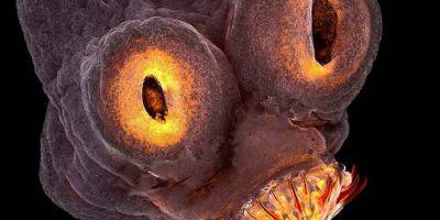 В мозге американца обнаружили ленточных червей. Причина — недожаренный бекон - tech.onliner.by
