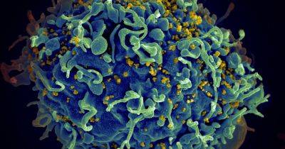 Вырежут ВИЧ прямо из клеток: ученые тестируют редактор генов CRISPR для борьбы с болезнью - focus.ua - Амстердам