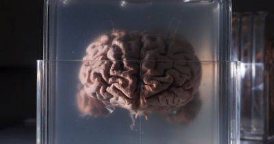 Ученые успешно заморозили и разморозили кусок человеческого мозга: подробности эксперимента - telegraf.com.ua - Китай
