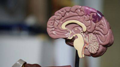 Neuralink получила разрешение FDA на проведение второй операции по вживлению мозговых имплантатов - 24tv.ua - Англия - Канада
