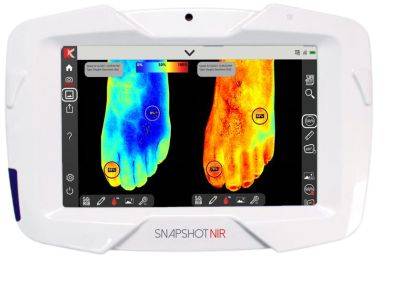 Портативное устройство для диагностики "Snapshot NIR" заменит ультразвук и рентген - gagadget.com