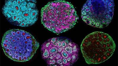Ученые впервые в истории вырастили «мини-мозг» из клеток нескольких людей - tech.onliner.by