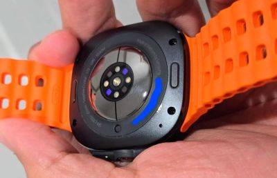 Спустя неделю использования с Samsung Galaxy Watch Ultra облазит краска - ilenta.com