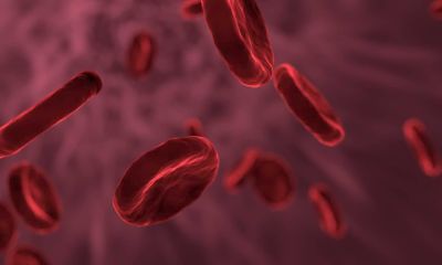 Анна Кореневич - Какие продукты могут спровоцировать появление тромбов - cursorinfo.co.il