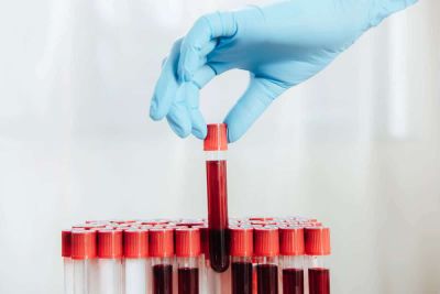 Какой продукт способен снизить уровень сахара в крови - ответ врачей - cursorinfo.co.il